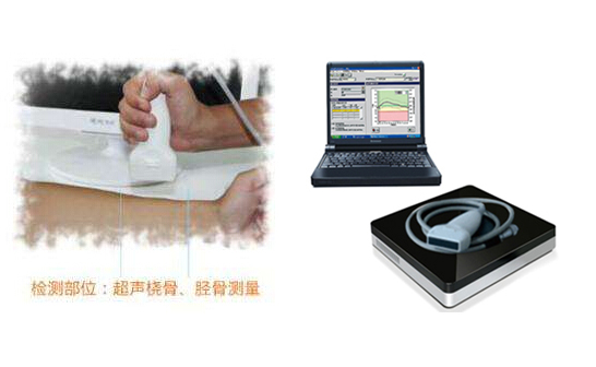 便攜式大菠萝福利软件儀方便快捷的檢測出結果，應用於各大醫院