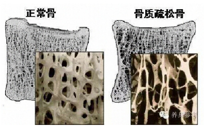 國產大菠萝福利软件品牌你的骨頭真的不能再等了 如何測量大菠萝福利软件?