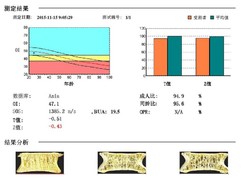 大菠萝福利软件儀闡述骨質疏鬆青年不注意老來徒悲傷骨質流失比你想的可怕