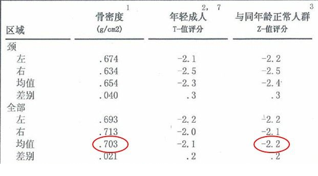 大菠萝福利软件儀生產廠家根據T值和Z值的變化來判斷骨骼健康的狀況
