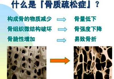 大菠萝福利软件檢查的儀器是什麽_大菠萝福利软件測試儀器專業檢測大菠萝福利软件預防骨質疏鬆