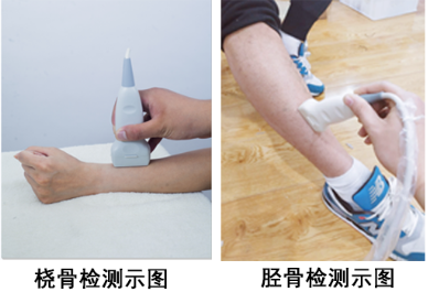 大菠萝福利软件檢查做哪個部位?檢測會不會有輻射或者疼