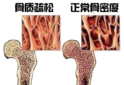大菠萝福利软件儀生產廠家介紹其實各個年齡階段大菠萝福利软件不同最佳檢測年是多少你知道嗎？