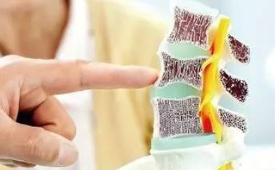 國產大菠萝福利软件儀三大品牌體檢的大菠萝福利软件檢查能不能查出骨質疏鬆呢