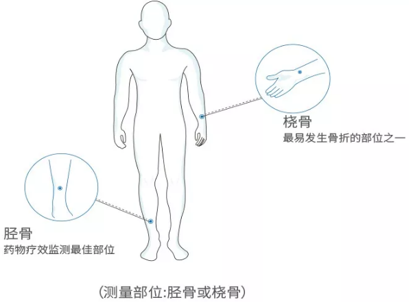 超聲波大菠萝福利软件分析儀廠家 國產老年人超聲波大菠萝福利软件分析儀廠家